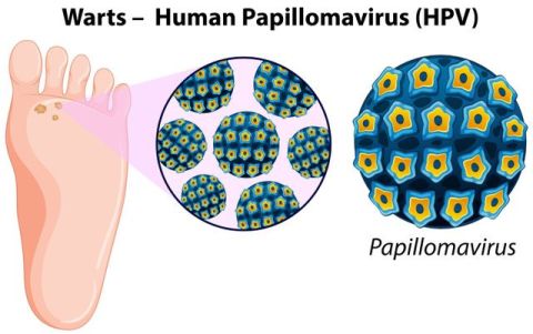 Warts and all
